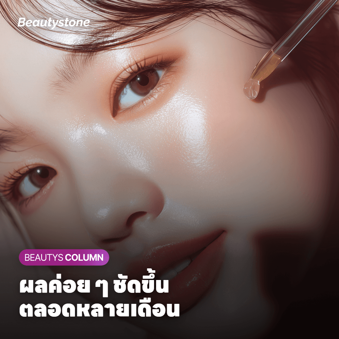 ช่วงที่การเปลี่ยนแปลงจาก Titanium Lifting ค่อย ๆ ชัดขึ้น
