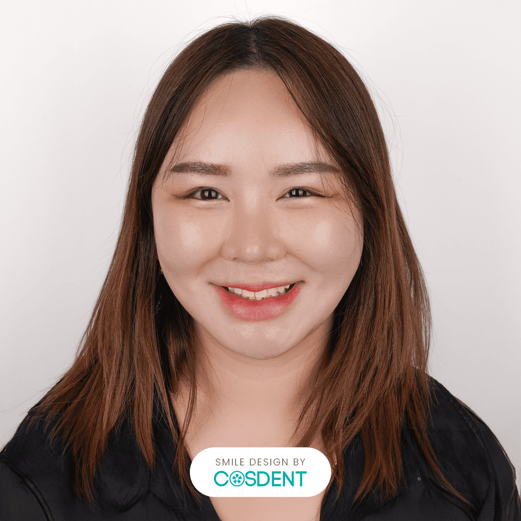 หน้ากลม ยิ้มกว้าง 16 ซี่