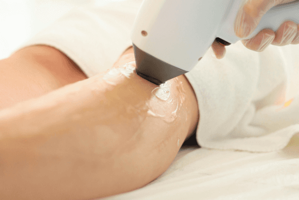 Pernas Bonitas e Saudáveis: Como Alinhar Estética com Saúde Vascular
