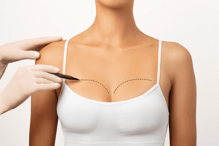 Breast Reduction