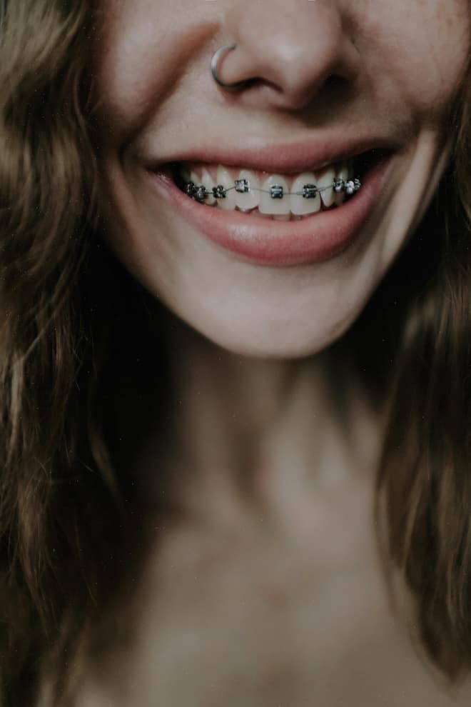 Comprehensive Orthodontic Treatments