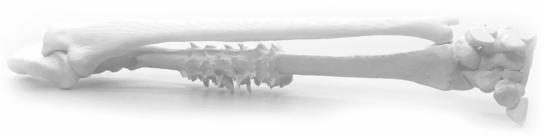 3d printed radius ulna forearm surgical planning medical model white polyterra pla