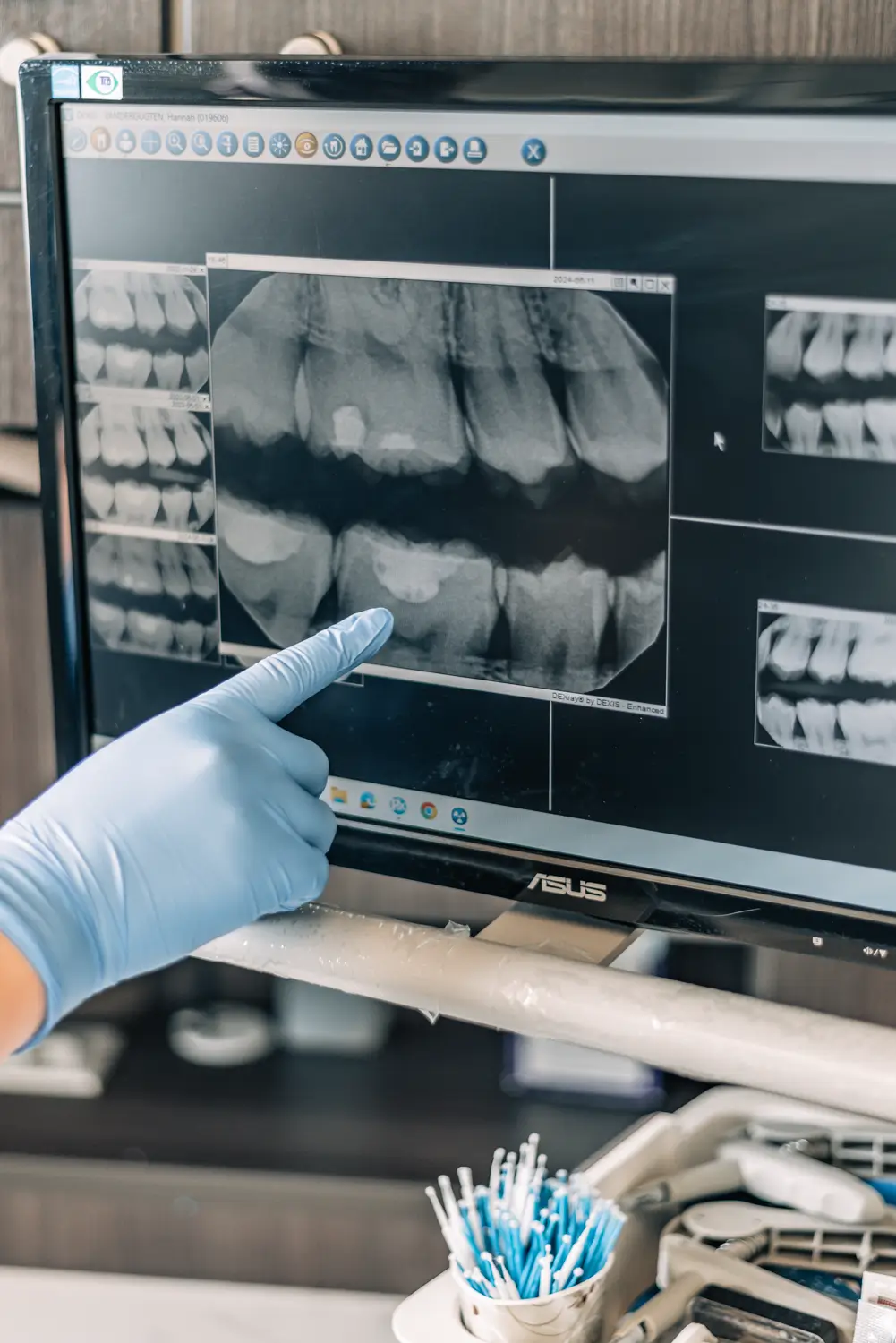 Summit View Dental Centre brand photography featuring people in a professional setting design detail
