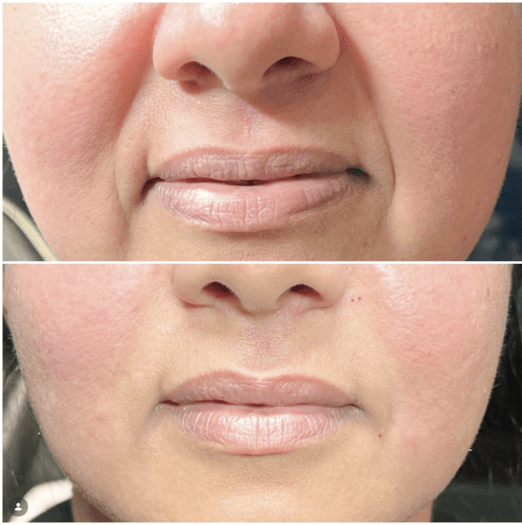 The Science Behind Anti-Aging Therapies