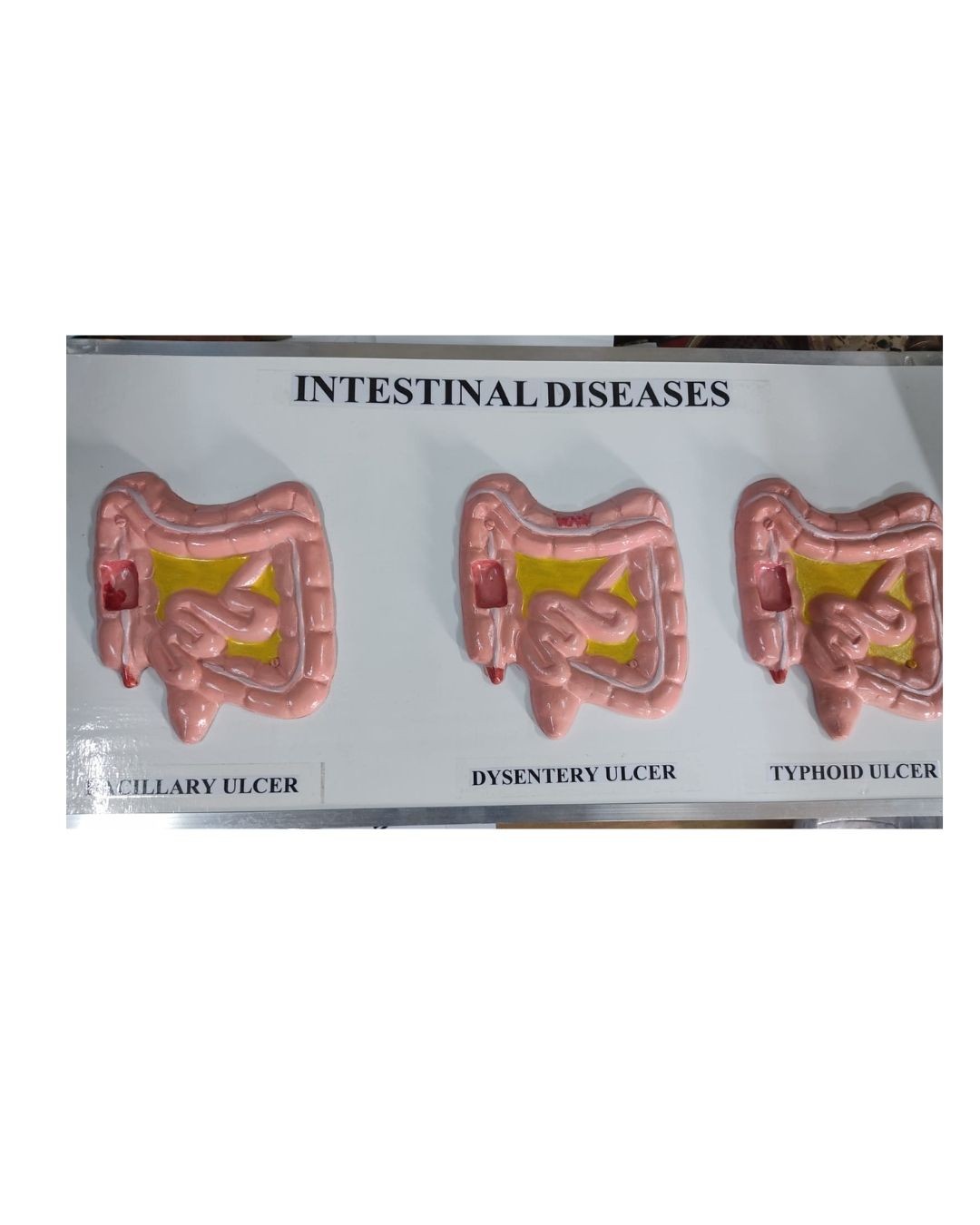 Intestinal Diseases