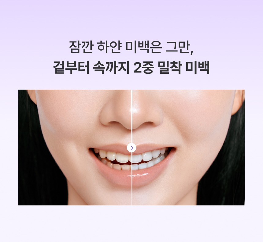 치아 겉면부터 속까지 2중 밀착 미백 효과를 비교한 이미지