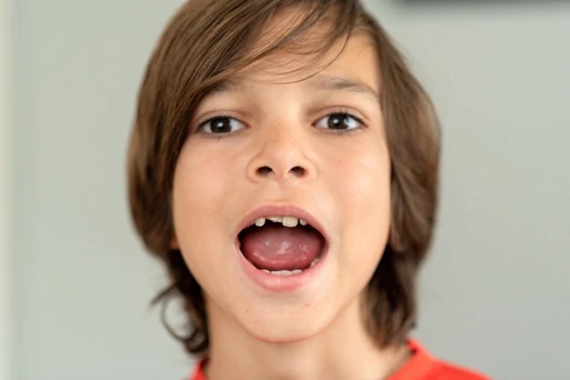 Garçon avec des dents cassées