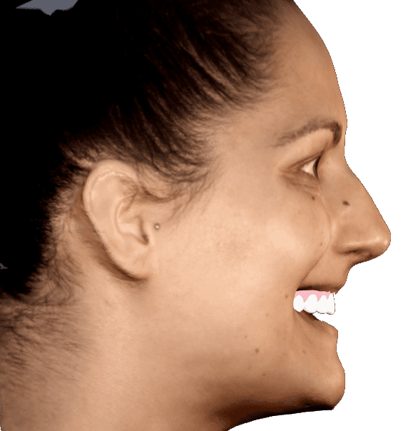 Face sken z boku s 3D DSD konceptom