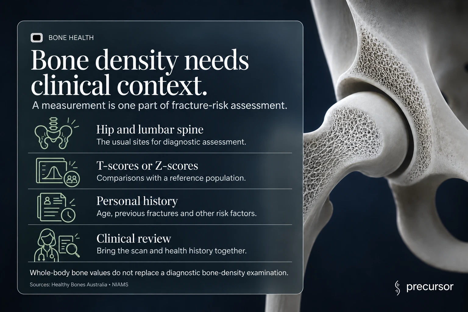 Bone-density assessment combining hip and spine measurements, T-scores or Z-scores, personal history and clinical review.