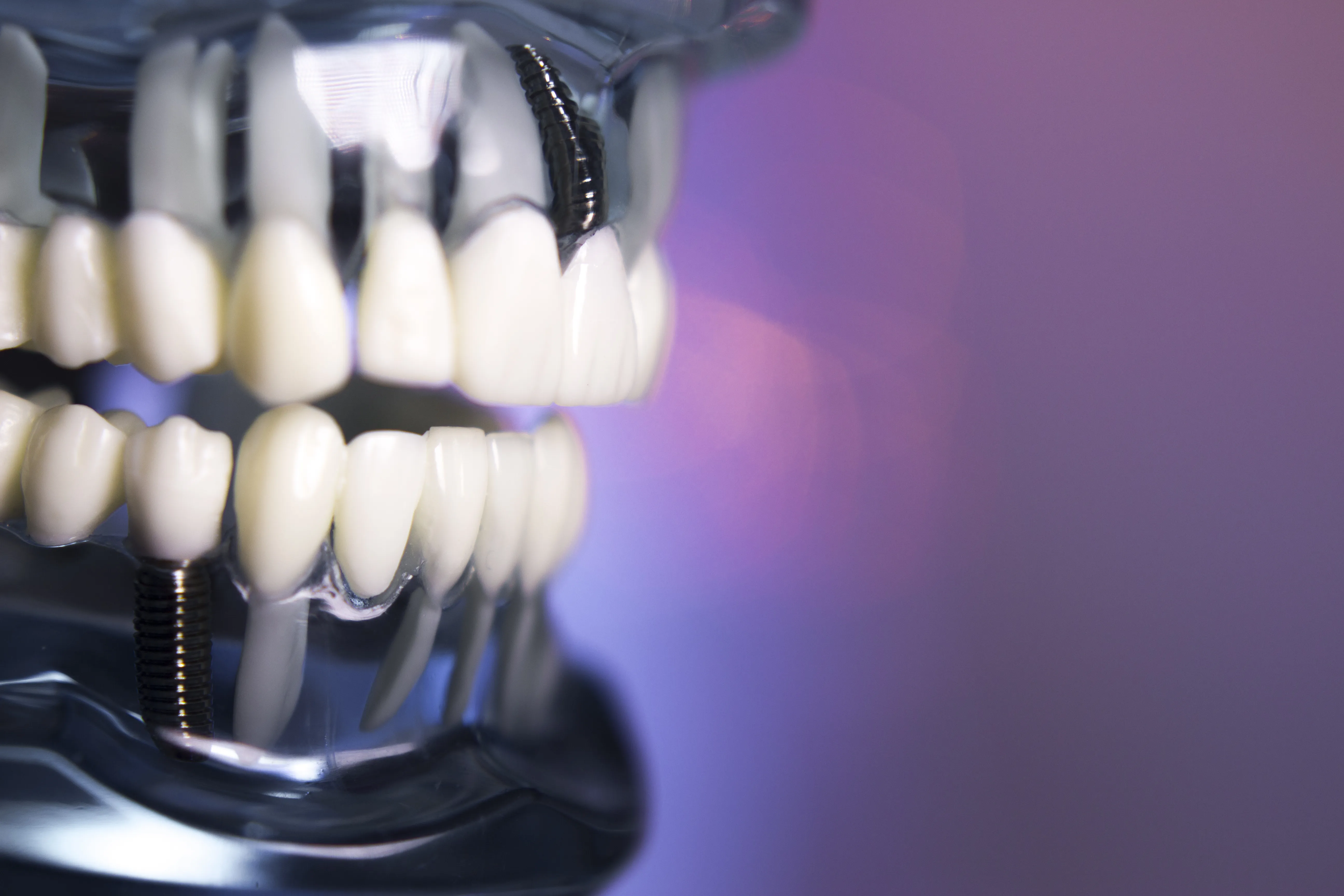 Fogászati Képzések - Implantológiai alapok - PraxEvents