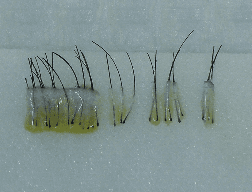 젠틀맥스프로플러스 제모는 전문적인 지식이 필요합니다.