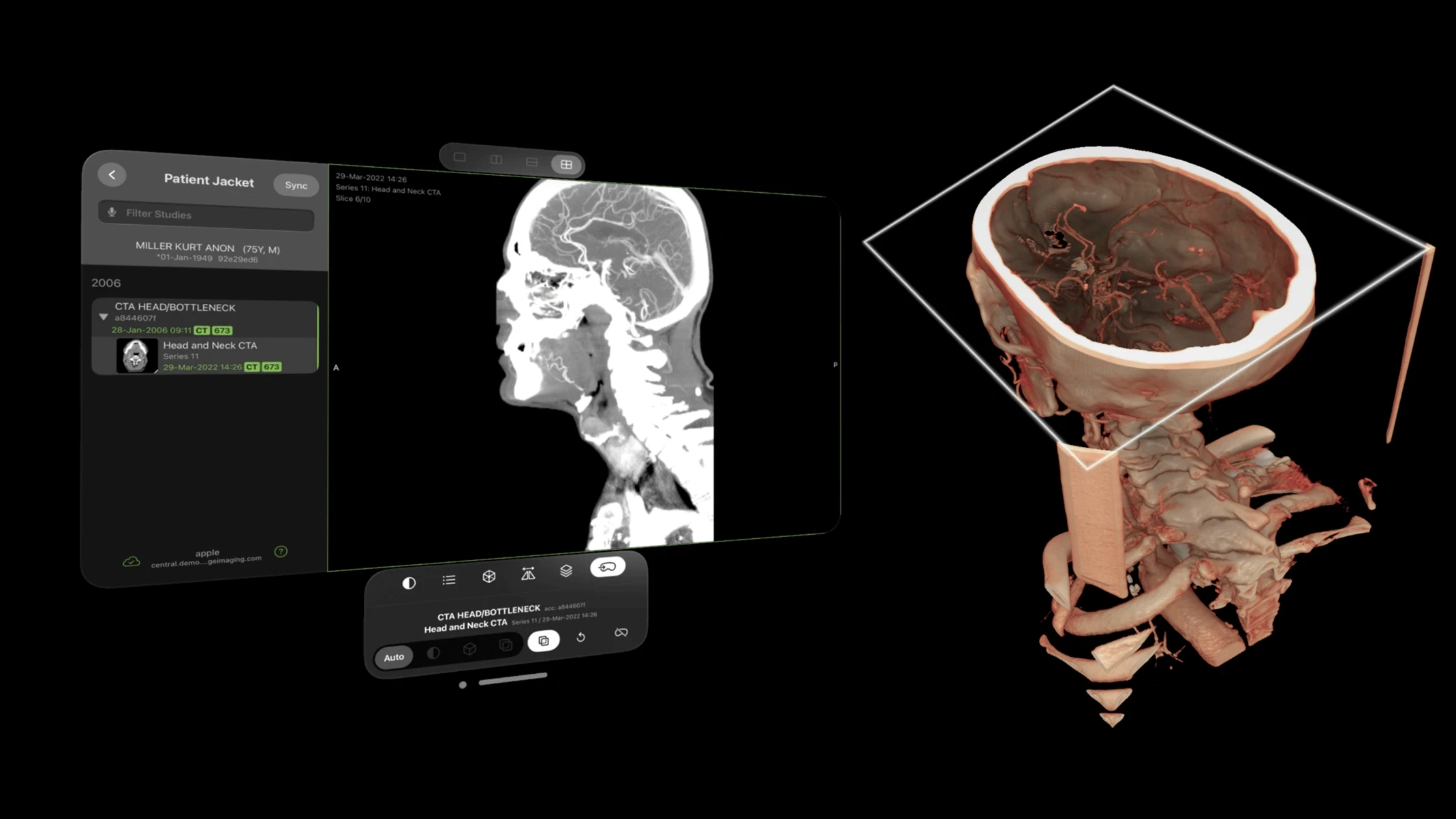 Visage Imaging spatial radiology platform for Apple Vision Pro enabling clinicians to view medical imaging in 3D space.