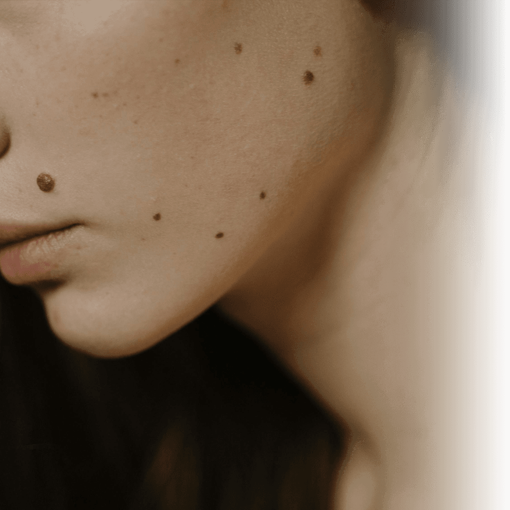 iyi tanımlanmış bir çene hattı ve genç bir boyun