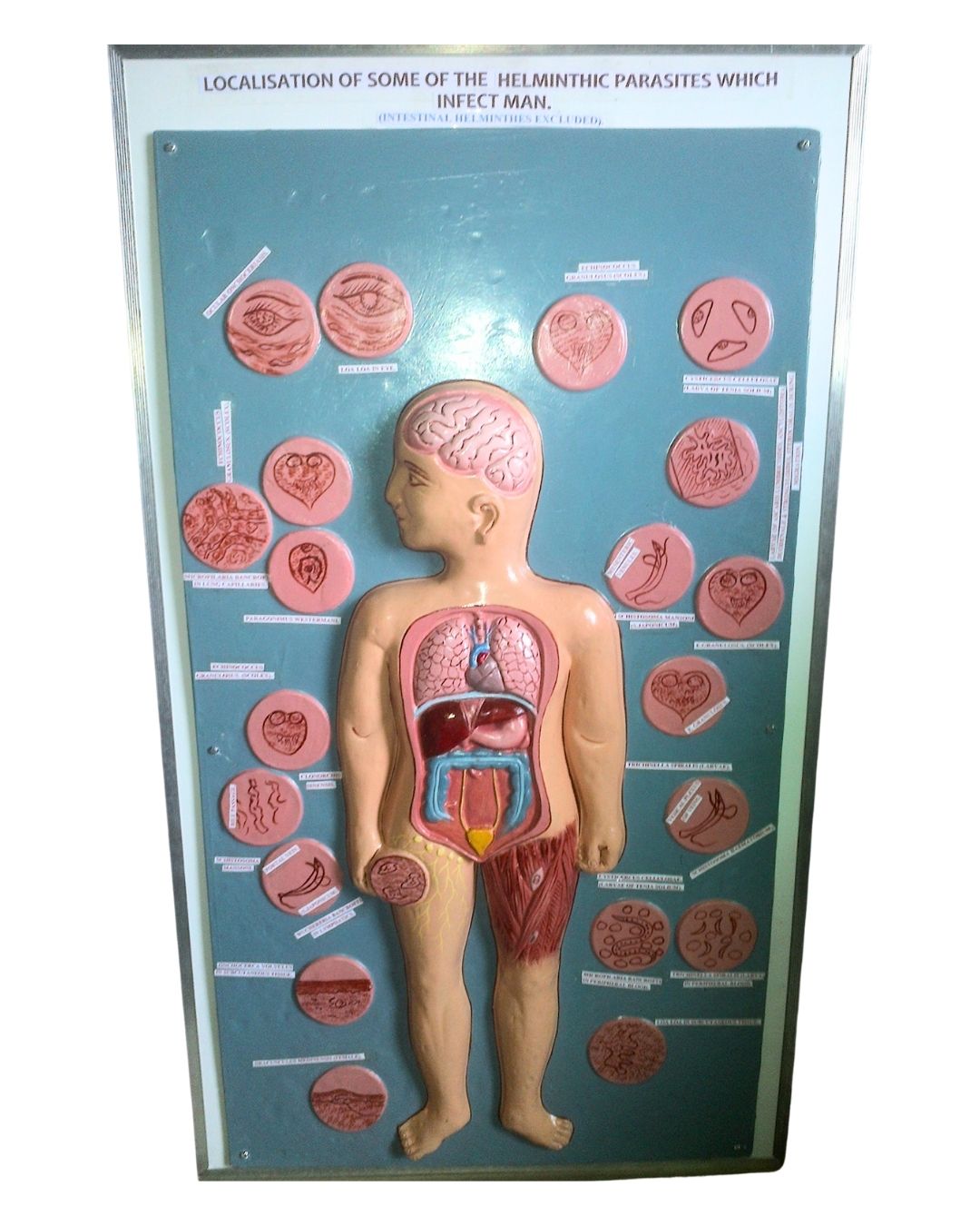 Localisation Of Some Of The Helminthic Parasites Which Infect Man