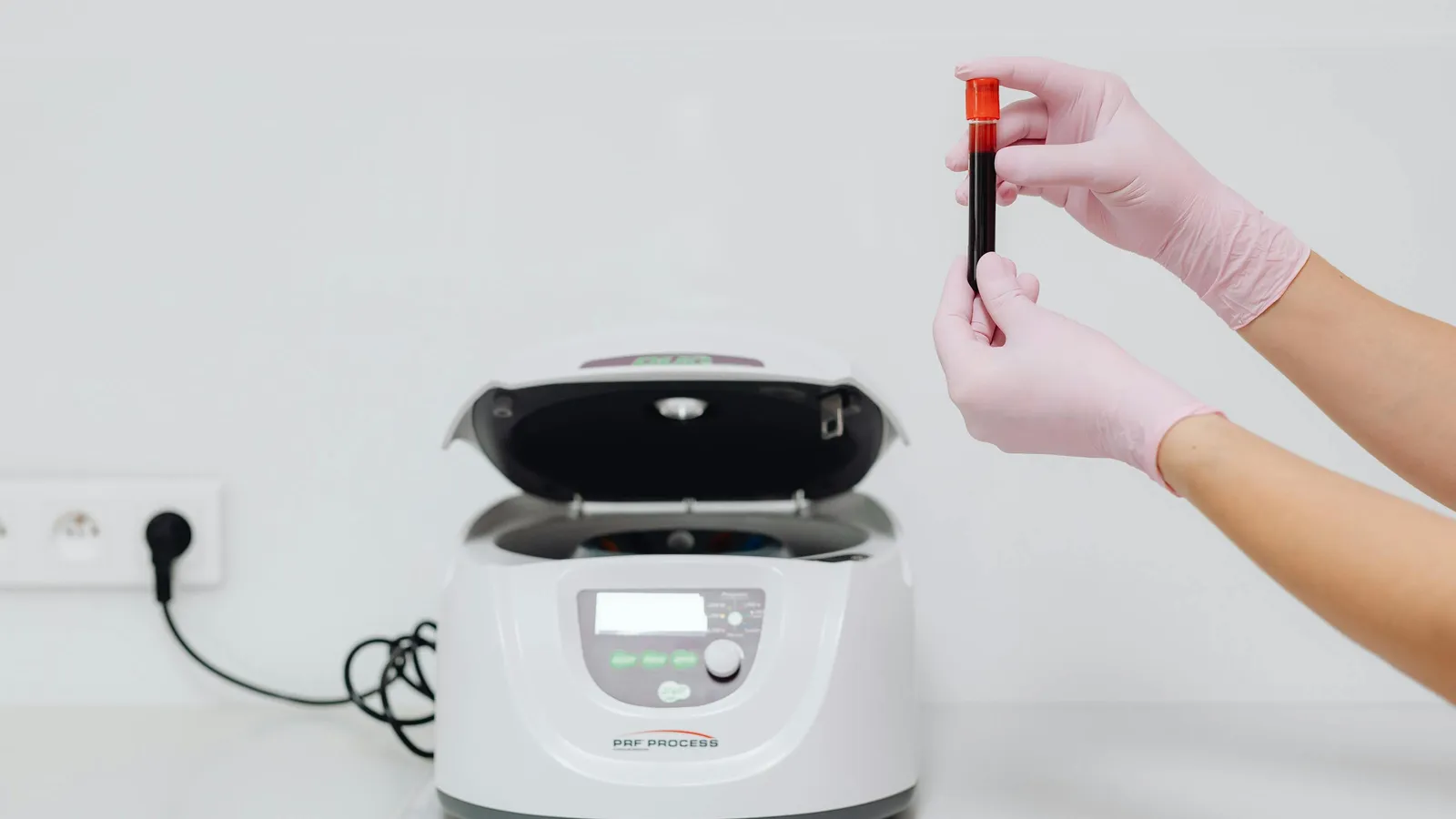 Low Monocyte Count: Causes, Risks, and What to Do Next