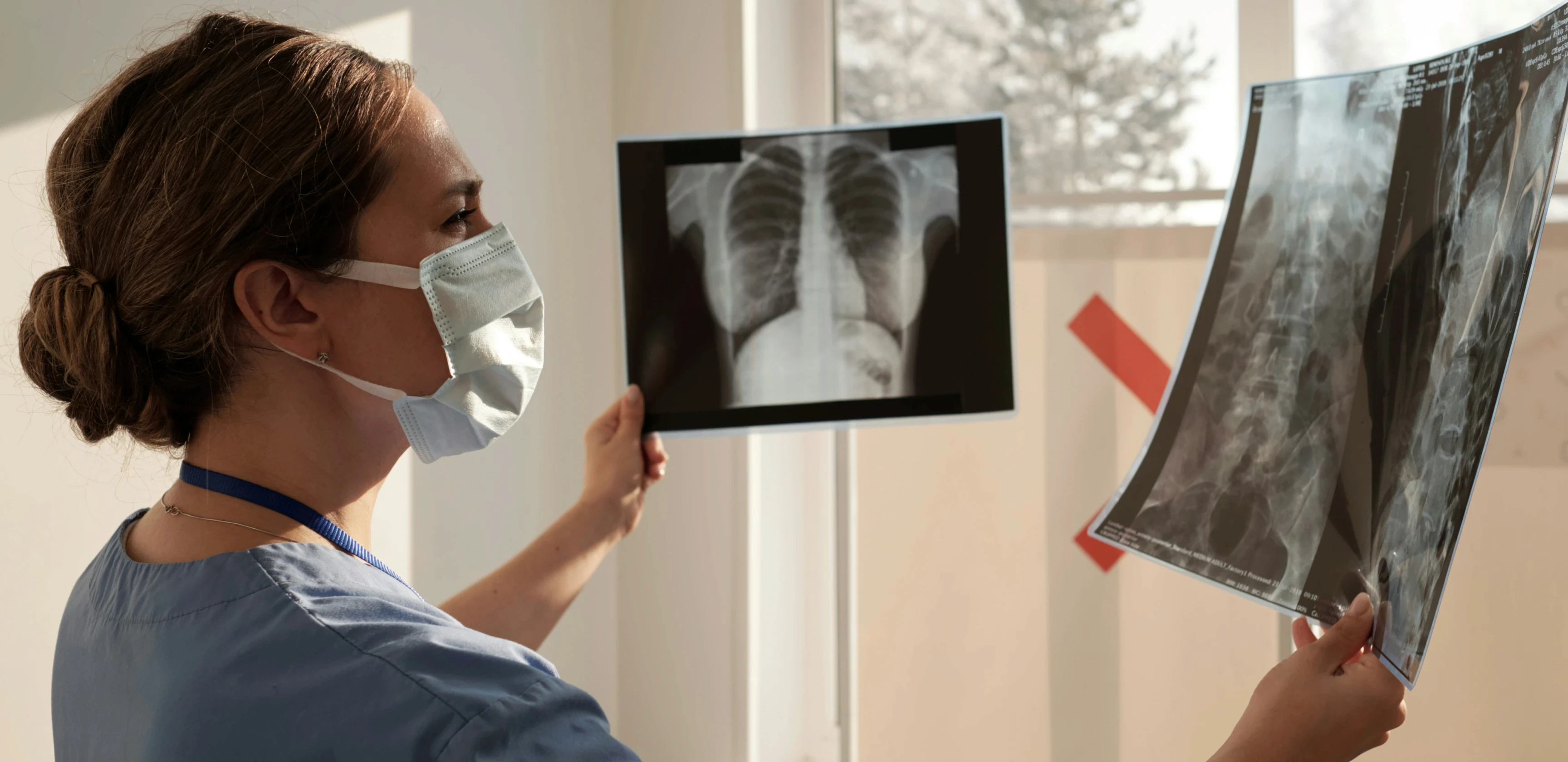 Radiologist inspecting a lung x-ray