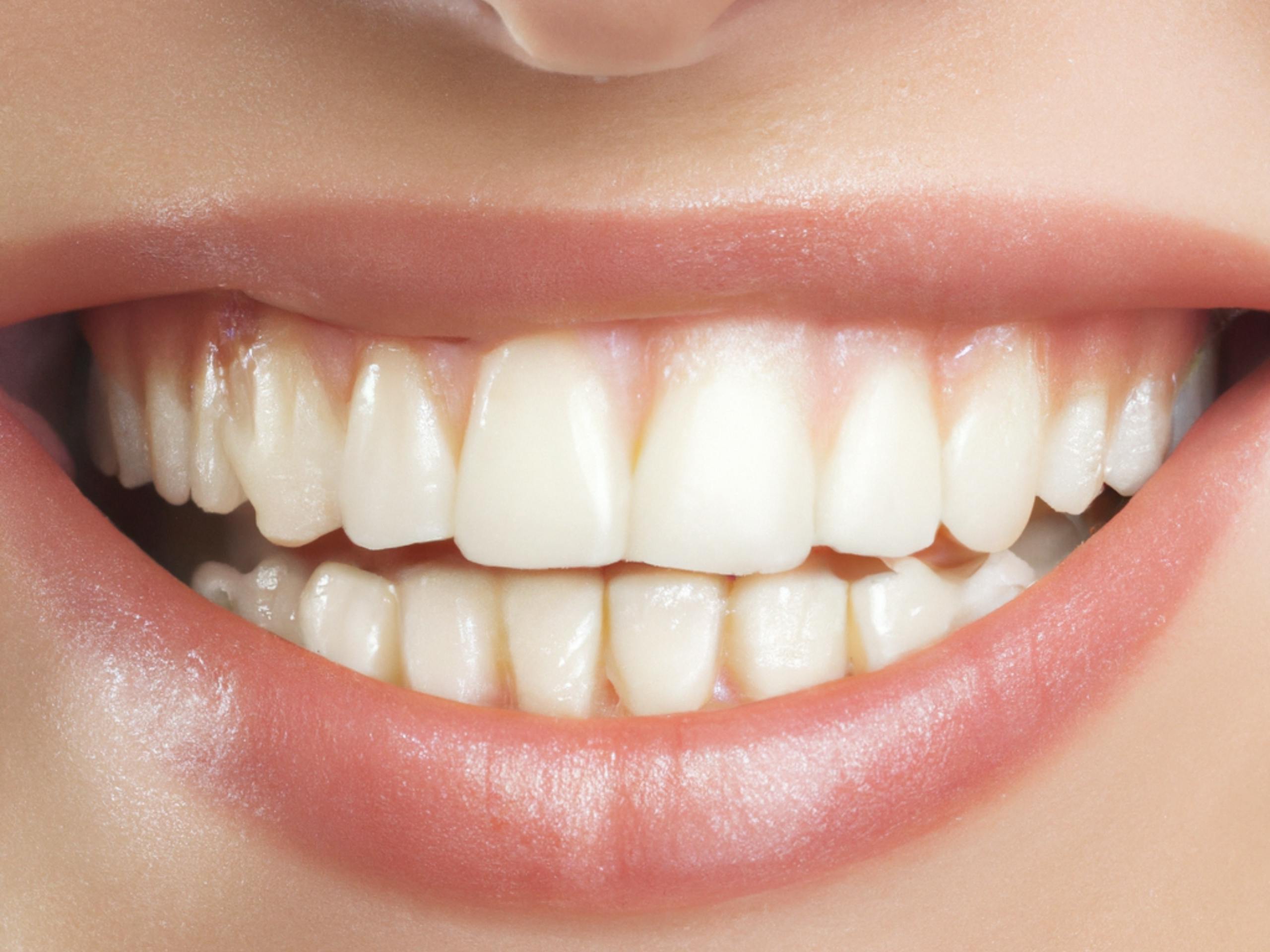Perfect Teeth