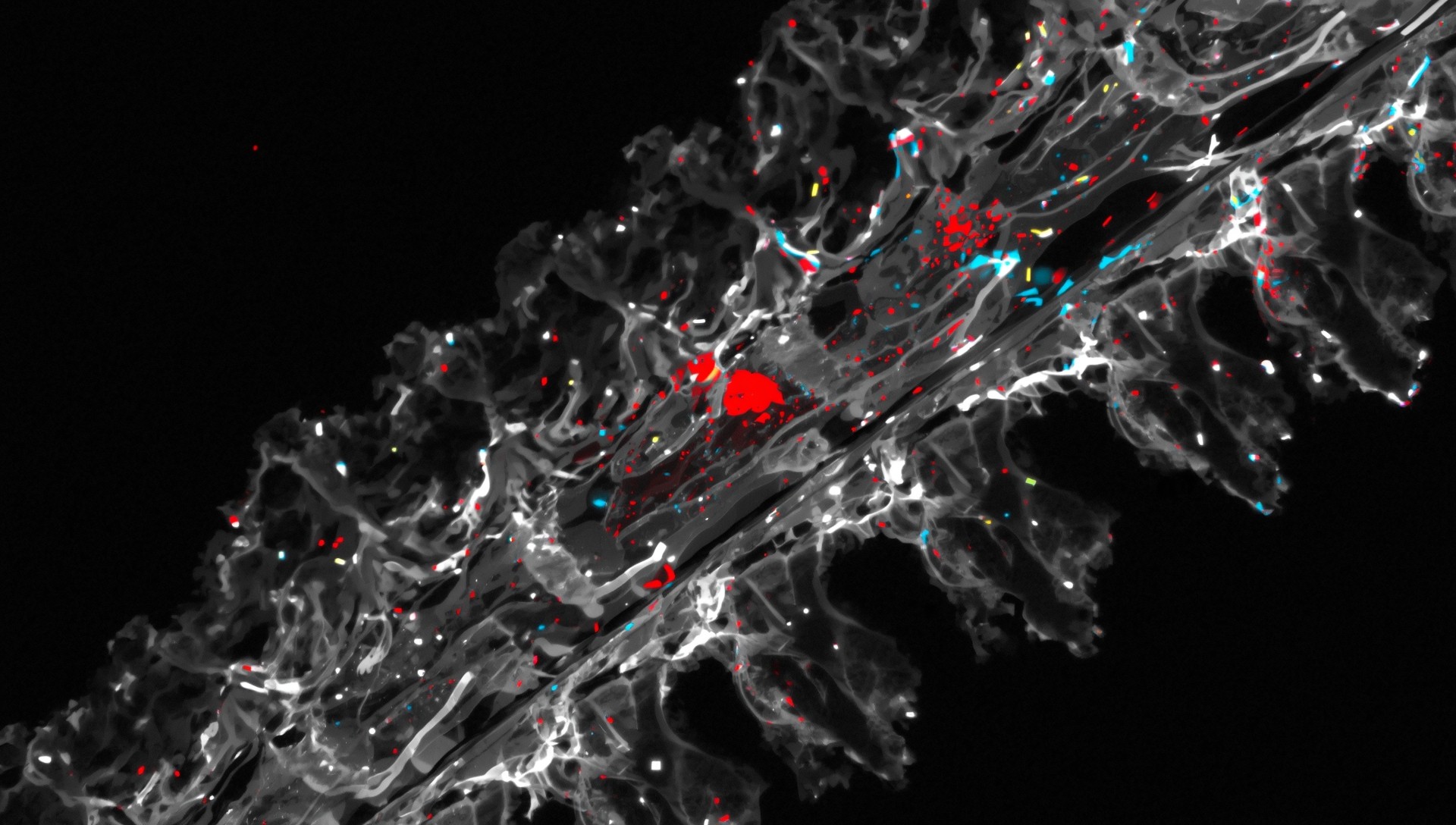 Neural Pathway Abnormality Analysis using Custom CNN