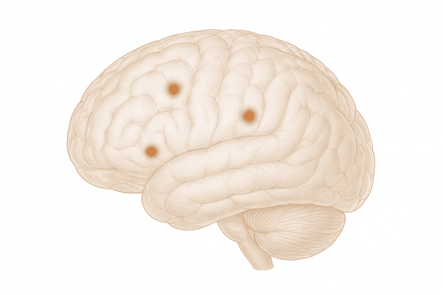Brain illustration showing limited, localized activity