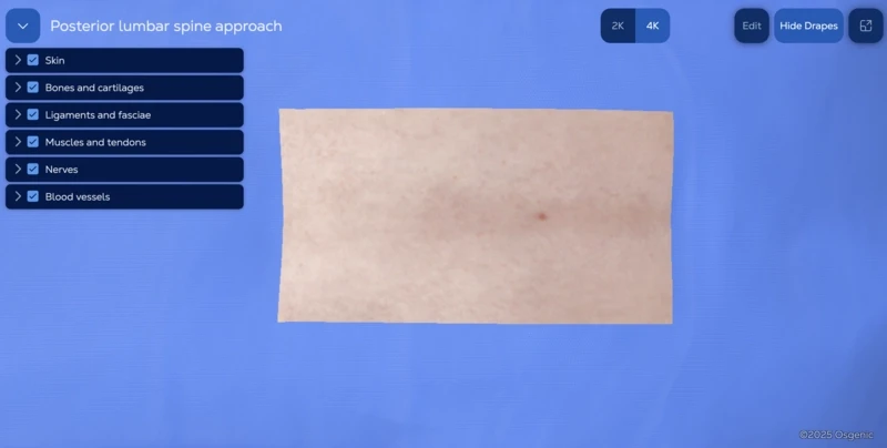 Lumbar microdiscectomy