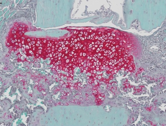 A large expanse of red and white tissue featuring a small section of pink, showcasing a vibrant color contrast.