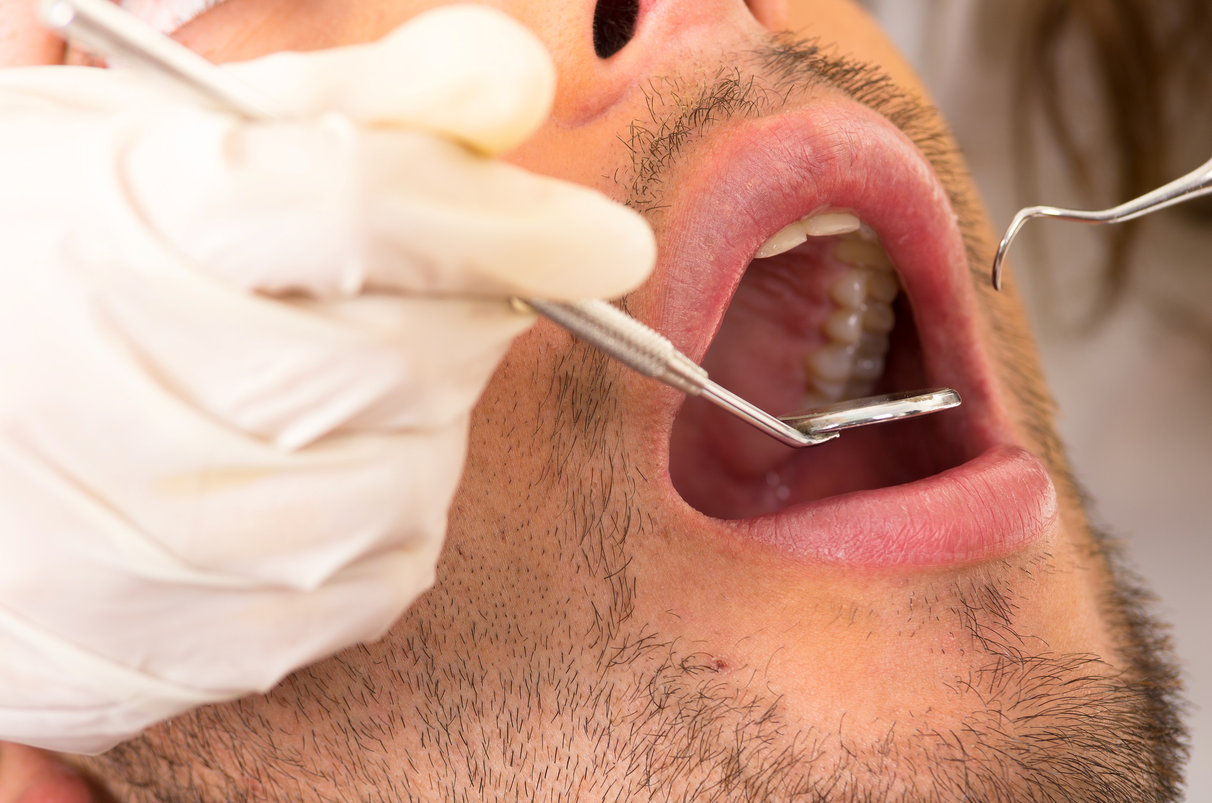 A dentist performs a dental examination on a patient, using a mirror and dental probe to inspect the teeth and gums.