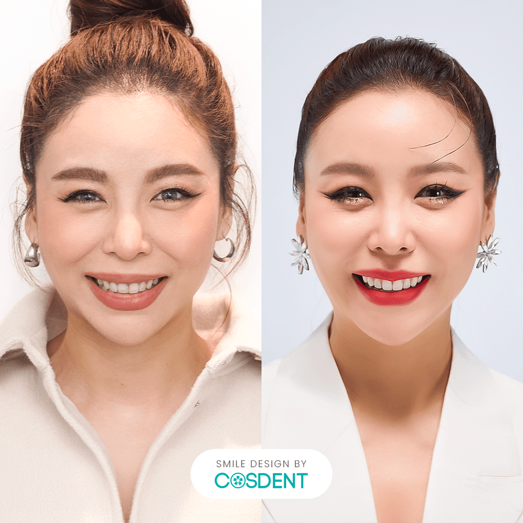 หน้าสามเหลี่ยม ยิ้มกว้าง 16 ซี่