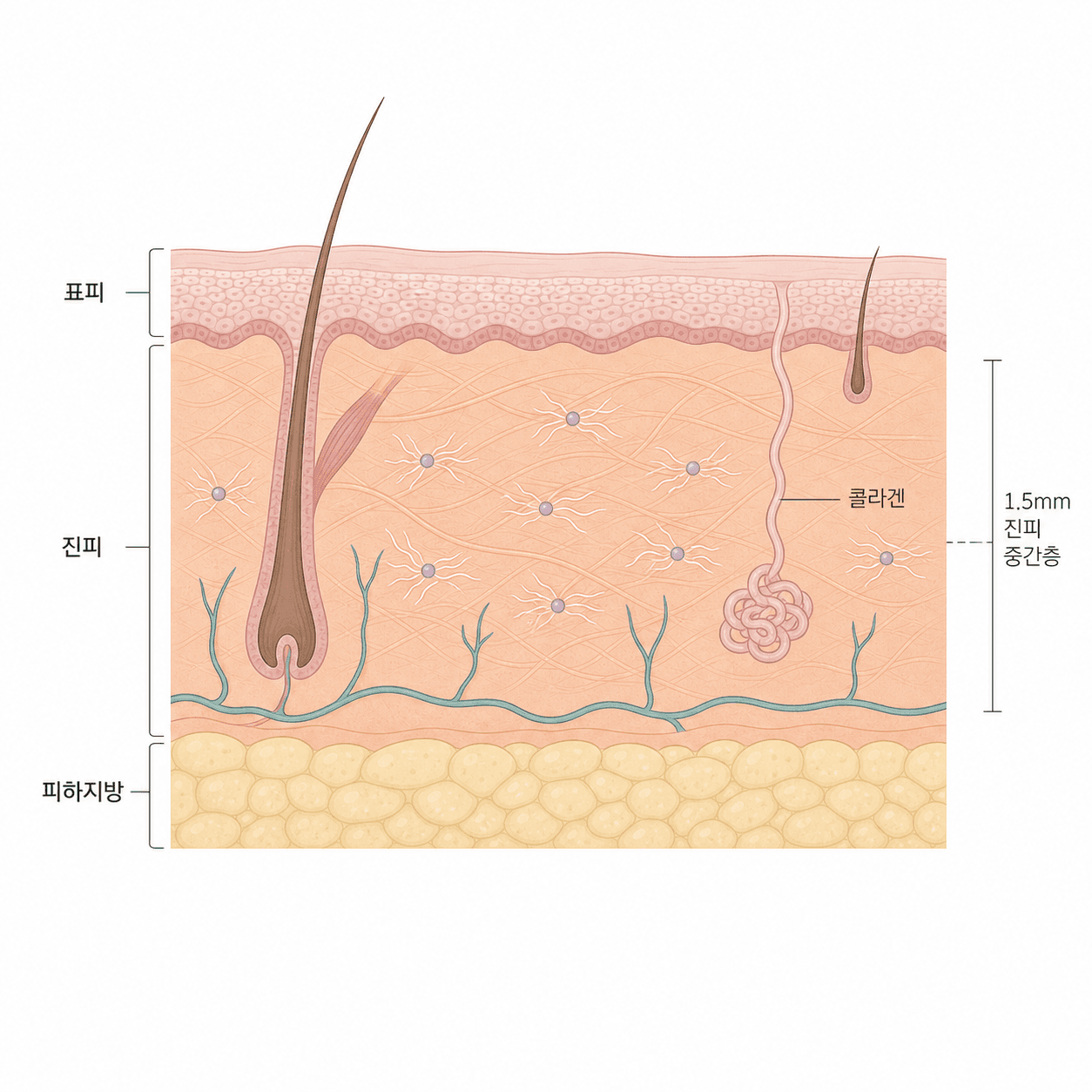 진피 안에서 콜라겐이 새로 차오르는 층 구조