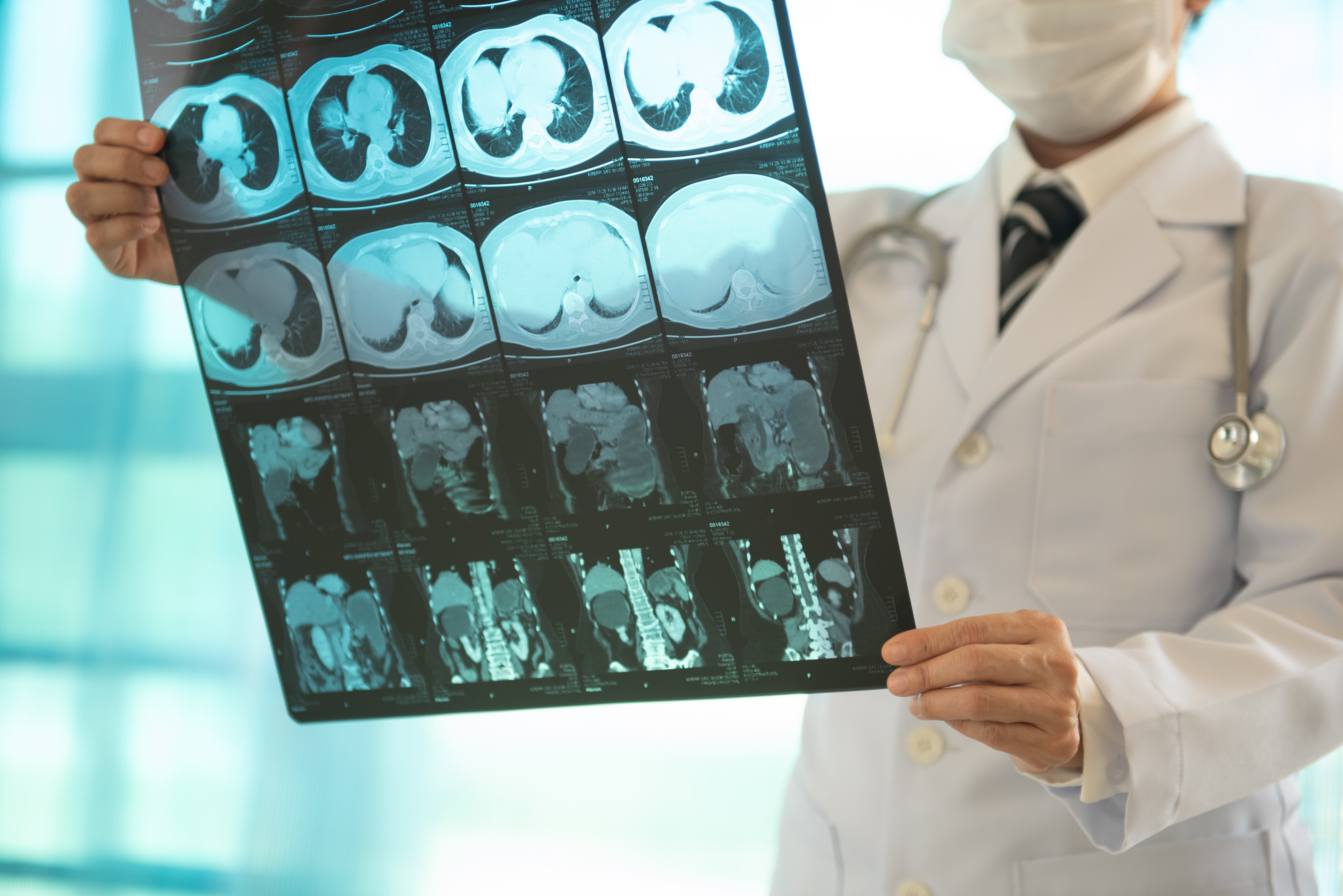 SCANNER - SPEEDOCTOR