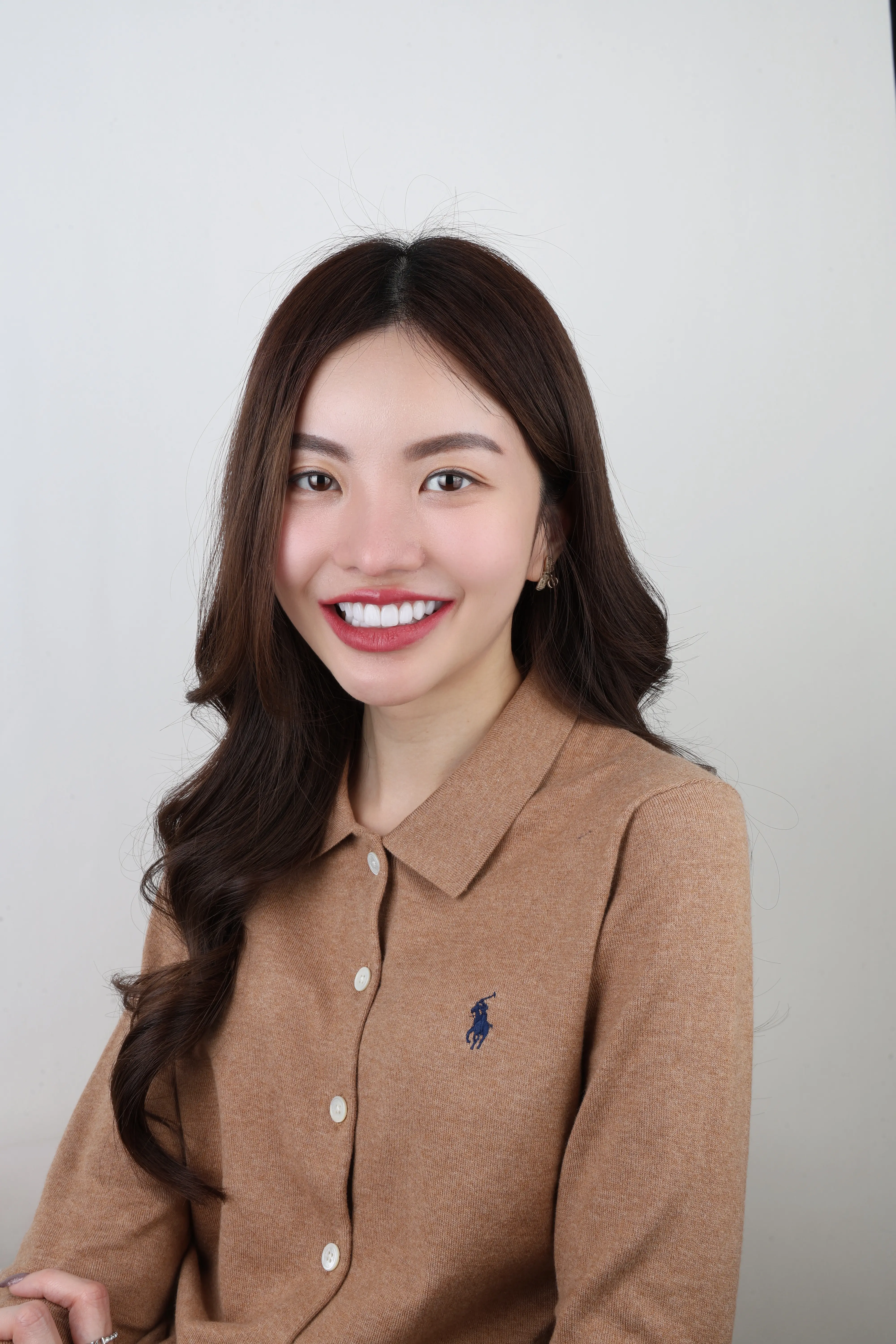 เคสทำวีเนียร์ หมอวรรณ cosdent smile design