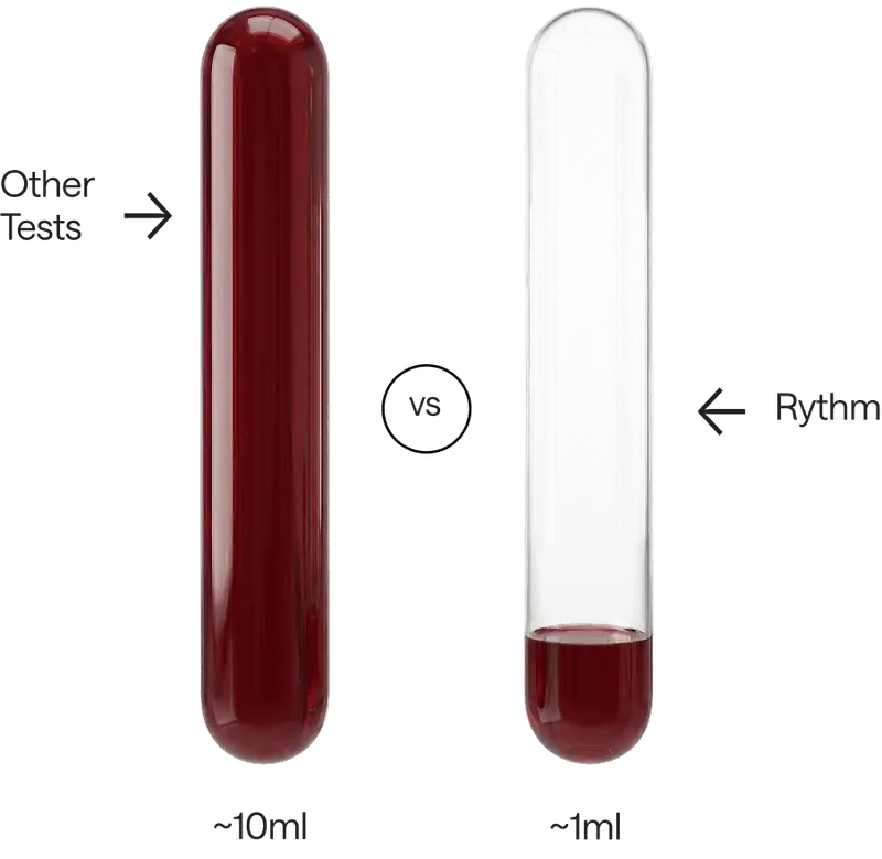 Comparison of two blood samples: a full test tube labeled “Other Tests” containing ~10 ml of blood, versus a smaller tube labeled “Rythm” containing ~1 ml of blood.