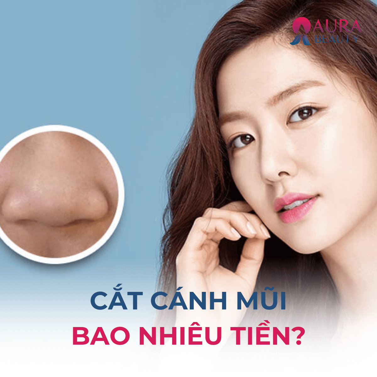 cắt cánh mũi bao nhiêu tiền