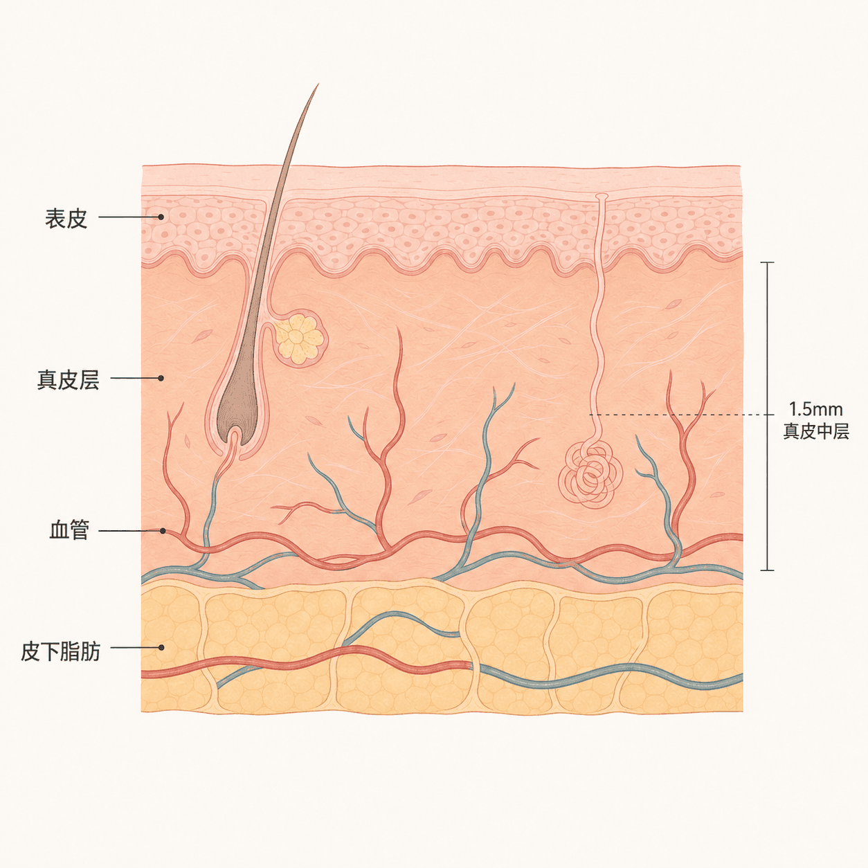 术后真皮里血管扩张的皮肤断面