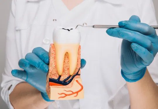 root canal therapy in Smyrna