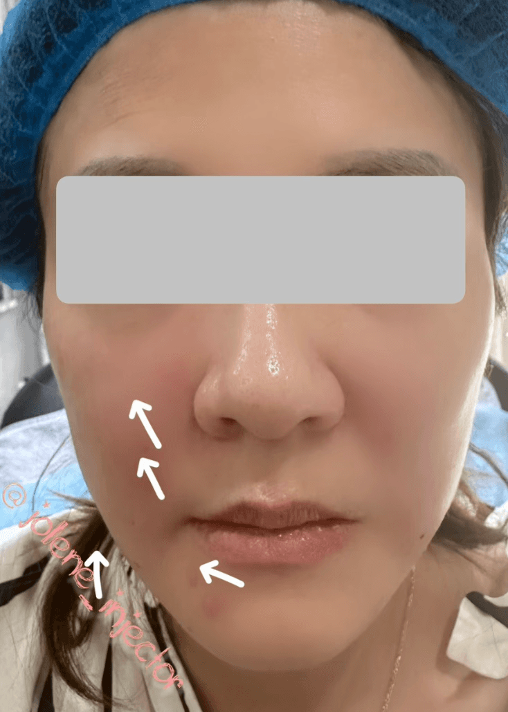 Before