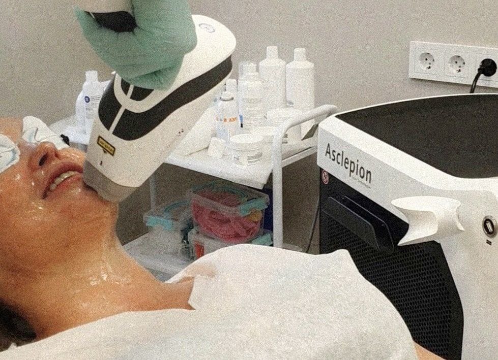 Mediostar laser