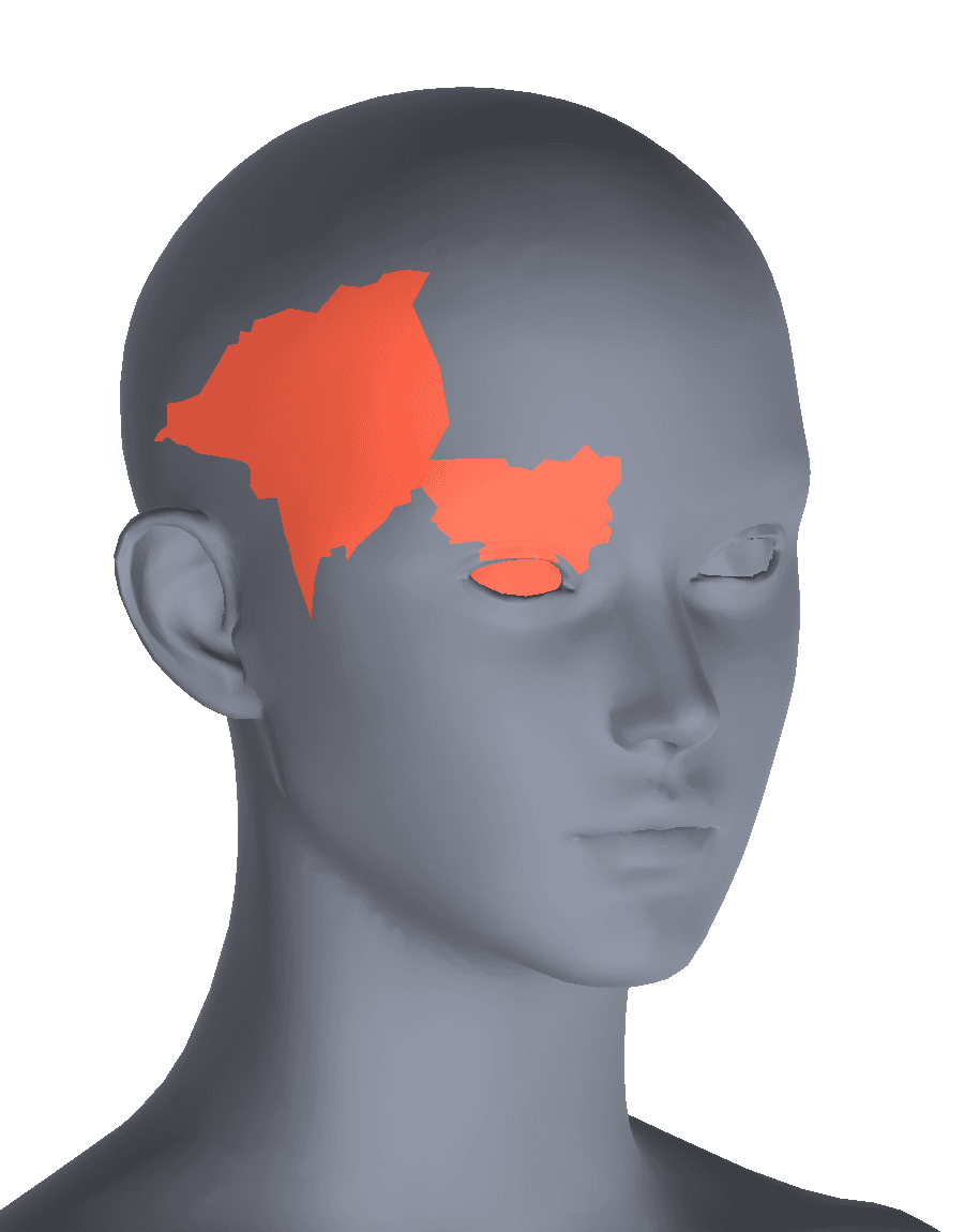 3D head with pain regions