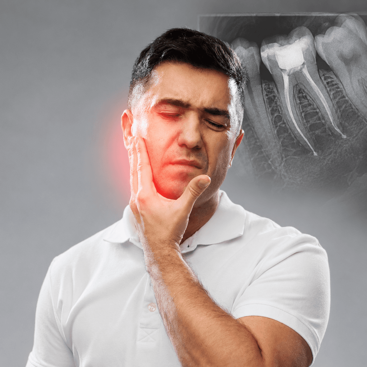 ¿Cuándo necesitas una Endodoncia?