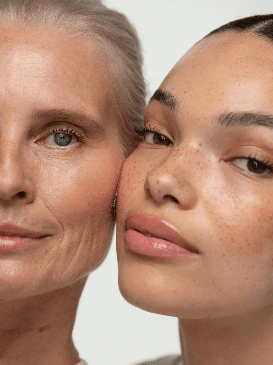 Expertos en Sculptra® (Ácido Poliláctico) en Terrassa, Barcelona. Heaven Clinics