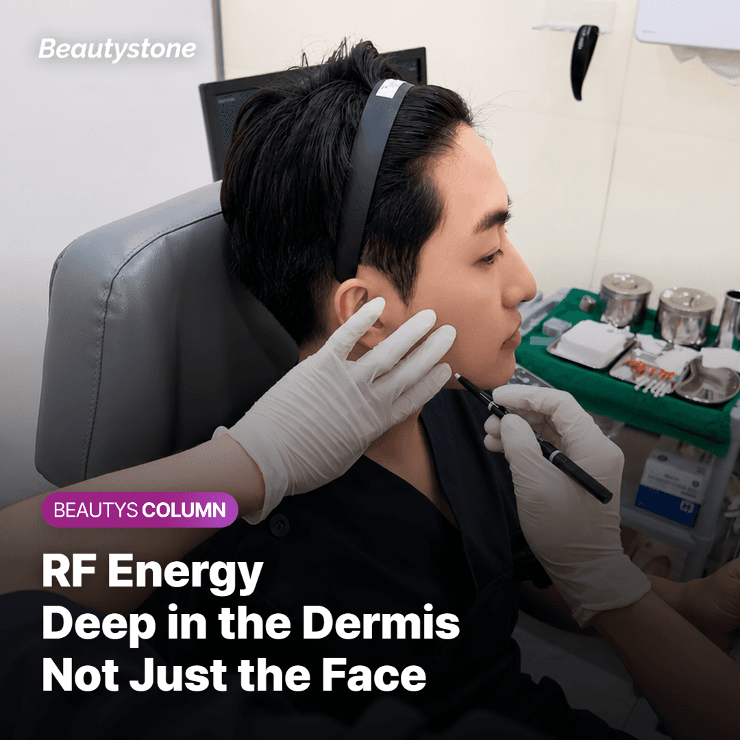 Comparison of Thermage tip sizes and energy settings for face versus neck treatment areas