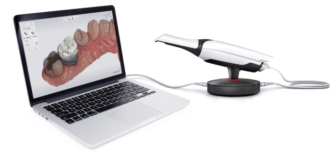 De Trios gebitsscanner