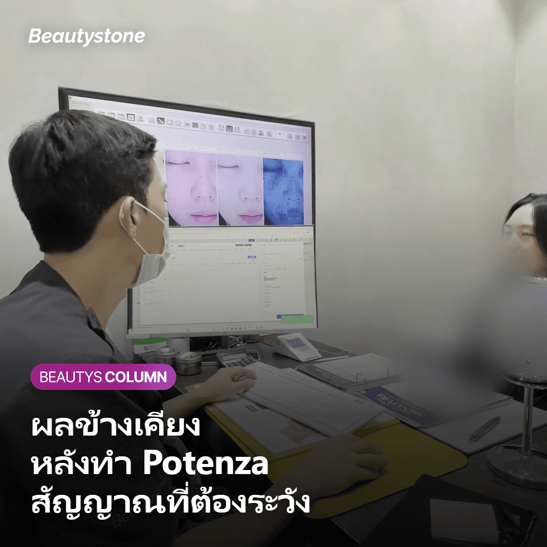 ผลข้างเคียงและสัญญาณที่ต้องระวังหลังทำ Potenza