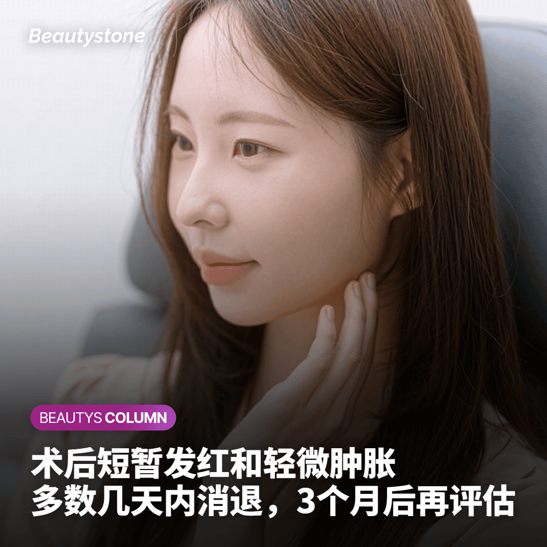 做之前值得了解的几点