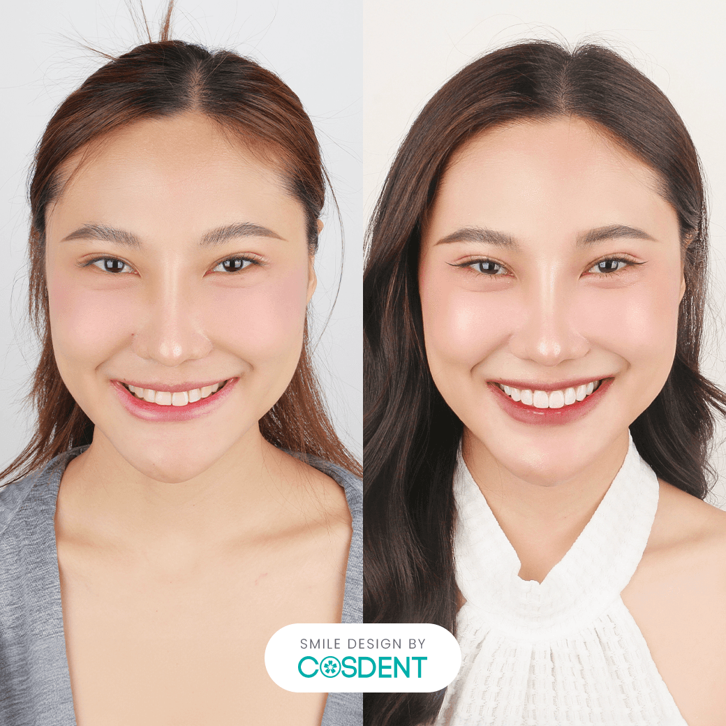 หน้าหวาน ยิ้มกว้าง 8 ซี่