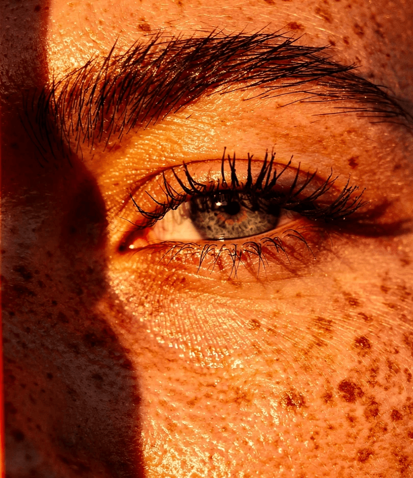 Close-up of a face, emphasizing one eye and brow in warm sunlight. Freckles are visible, with stark shadows creating a dramatic, contemplative mood.
