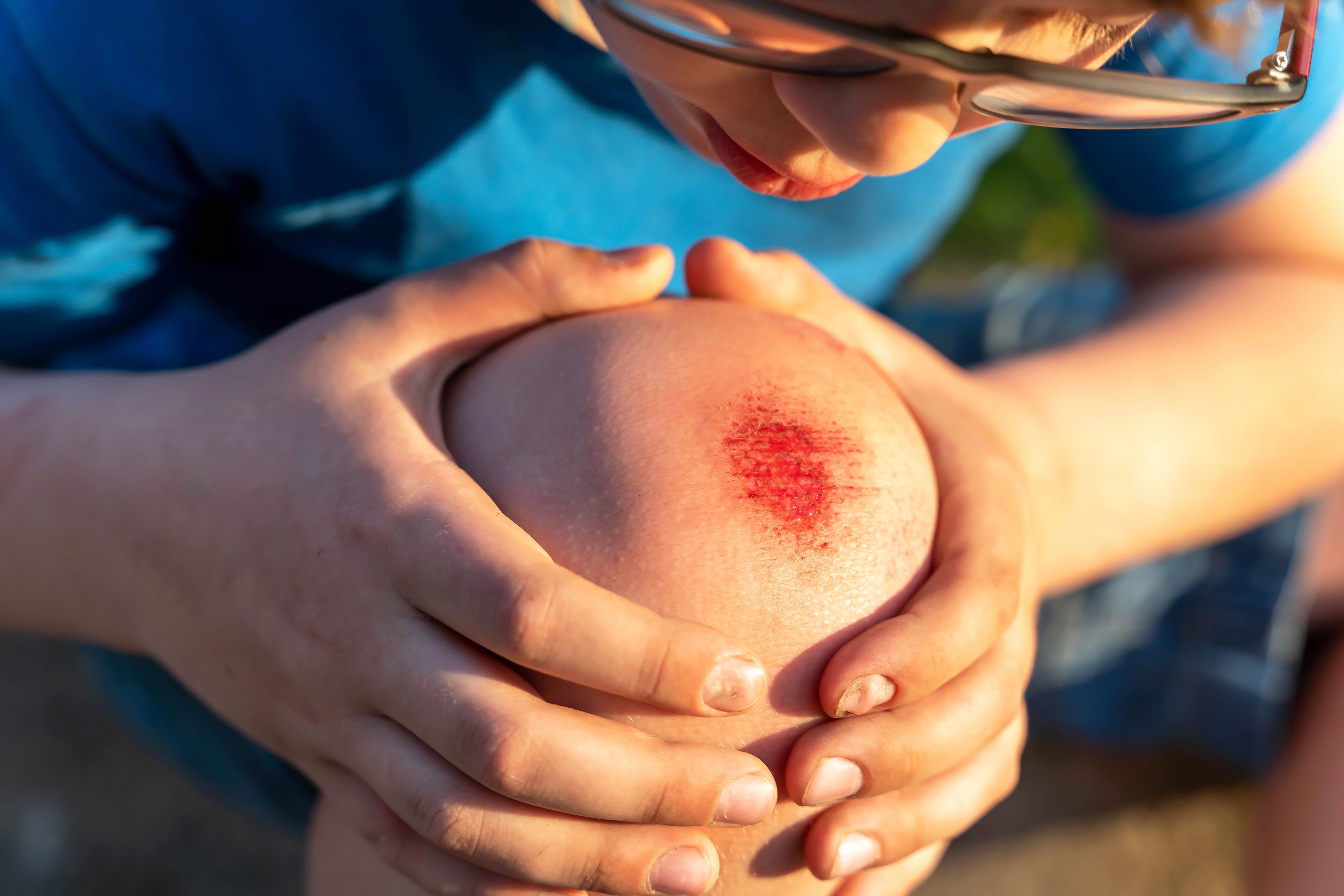 What to Expect After Ulcer and Wound Care