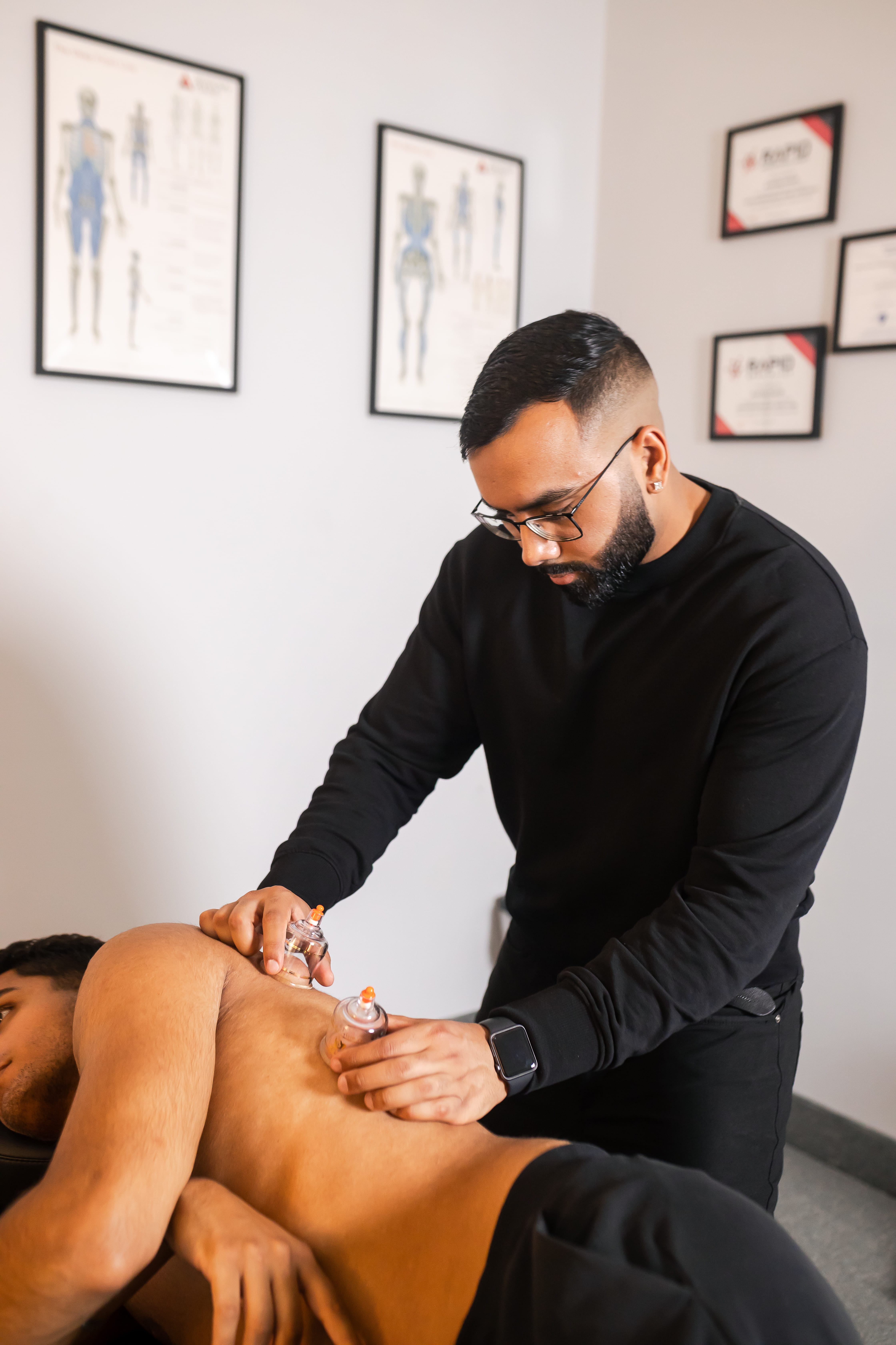 physiotherapist applying cupping treatment to patient’s frozen shoulder