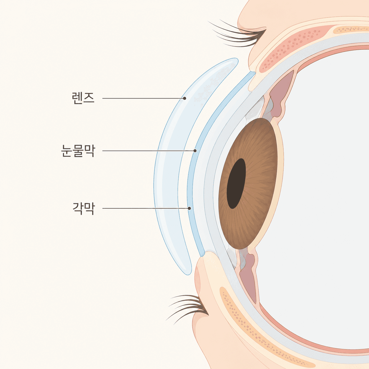 각막 위 눈물막과 그 위에 얹히는 콘택트렌즈