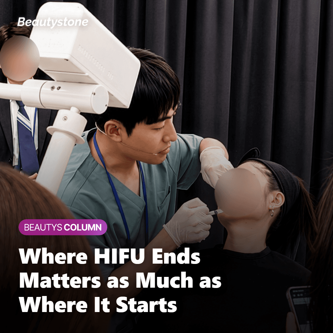 Illustrated diagram showing where the HIFU boundary forms below the jawline when only the face is treated