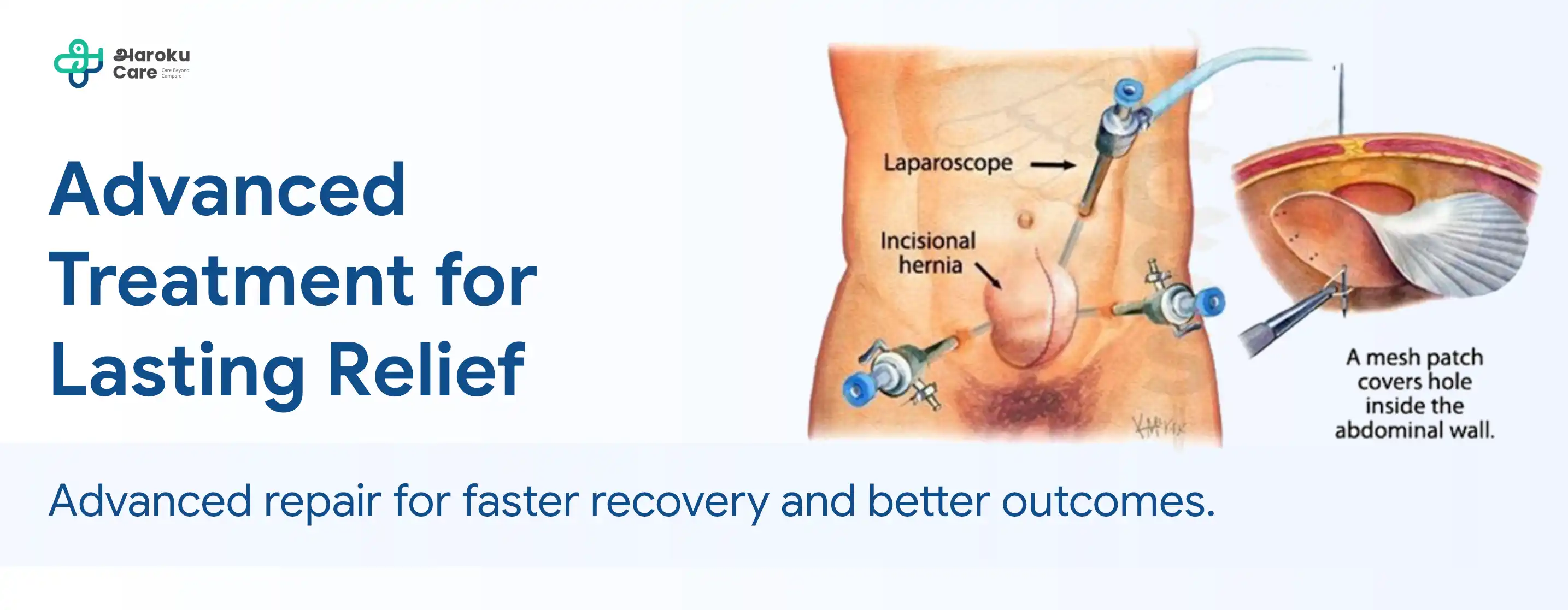 Advanced Treatment for Anal Abscess